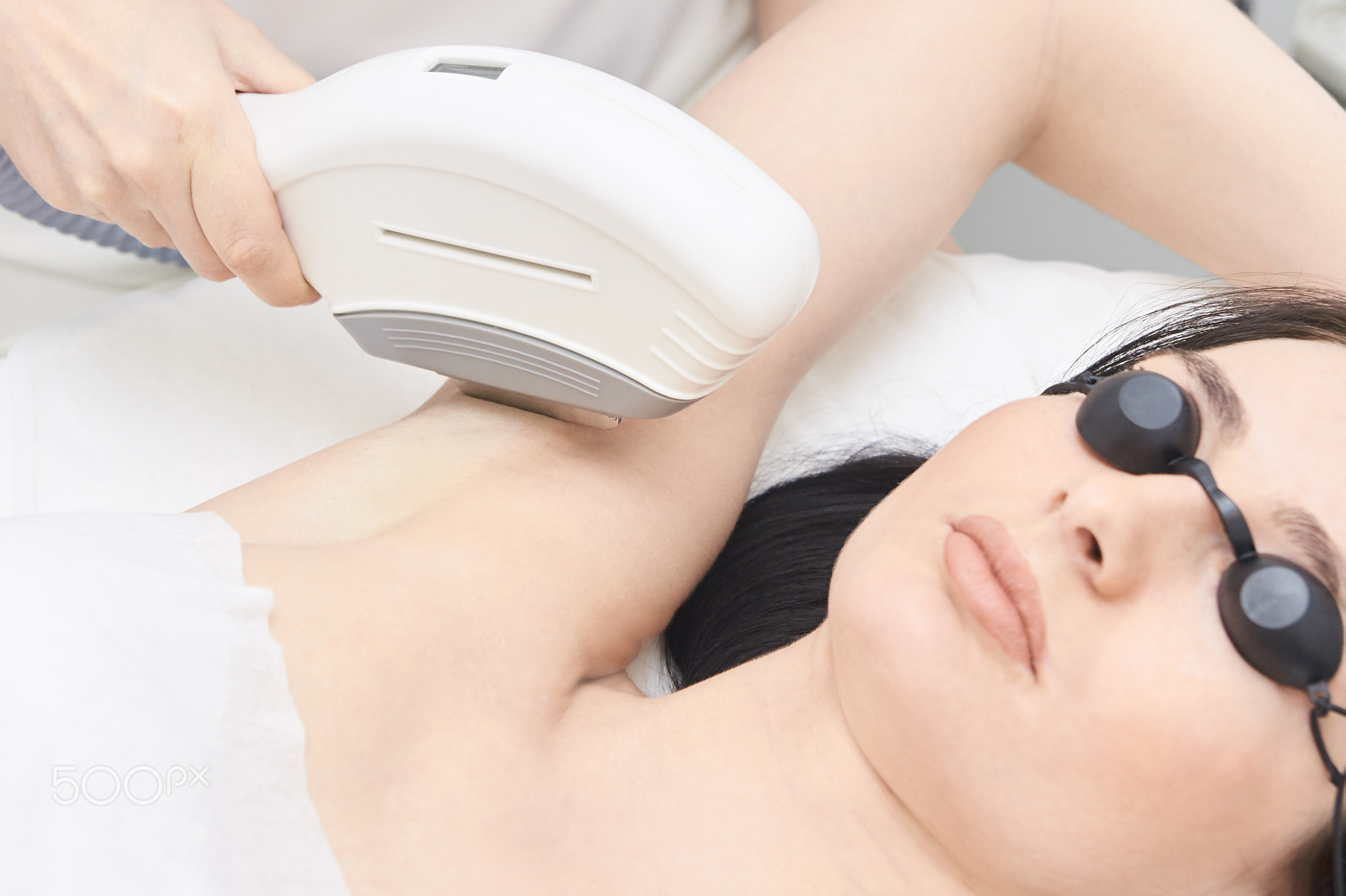 Medical procedure. Bright skin. Removing underarm hair. Laser ha