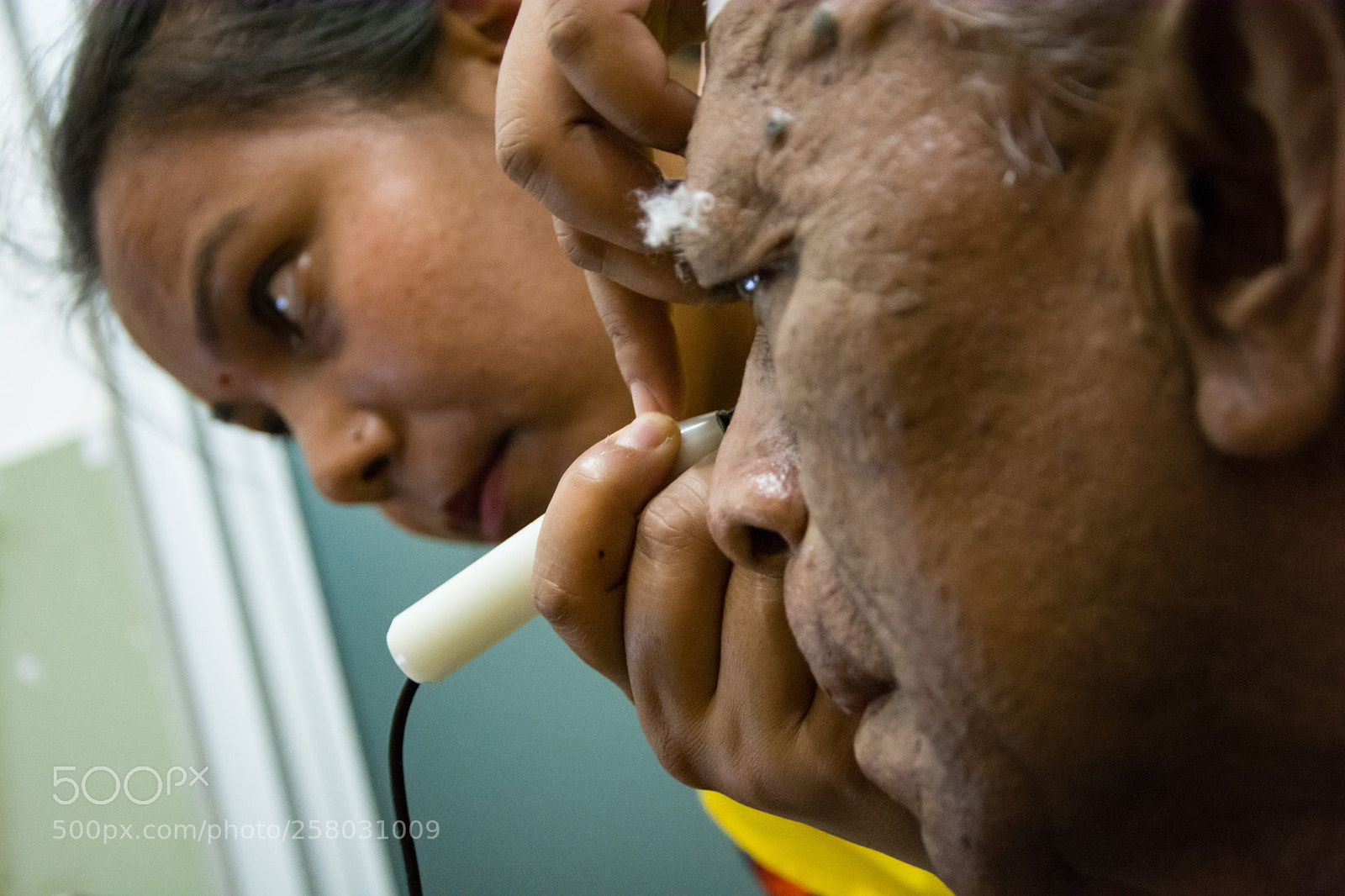 Nikon D7100 sample photo. Patient on biometry photography