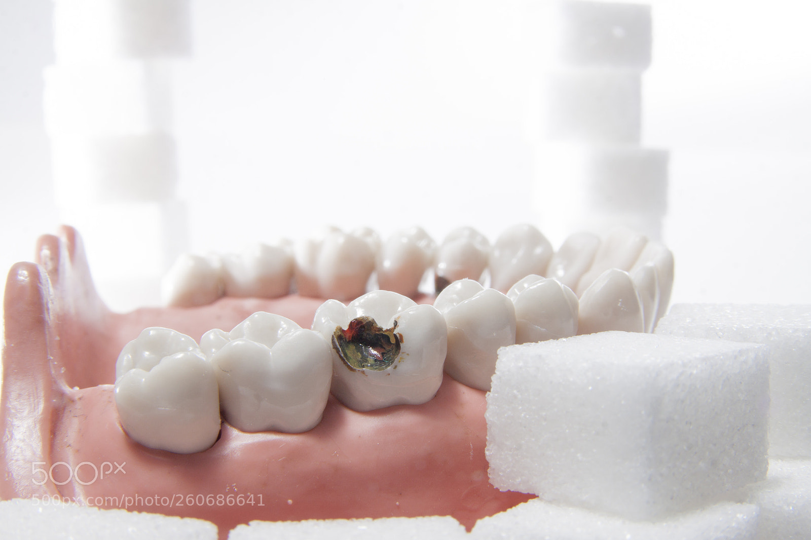 Canon EOS 50D sample photo. Karies - baustelle zahn photography