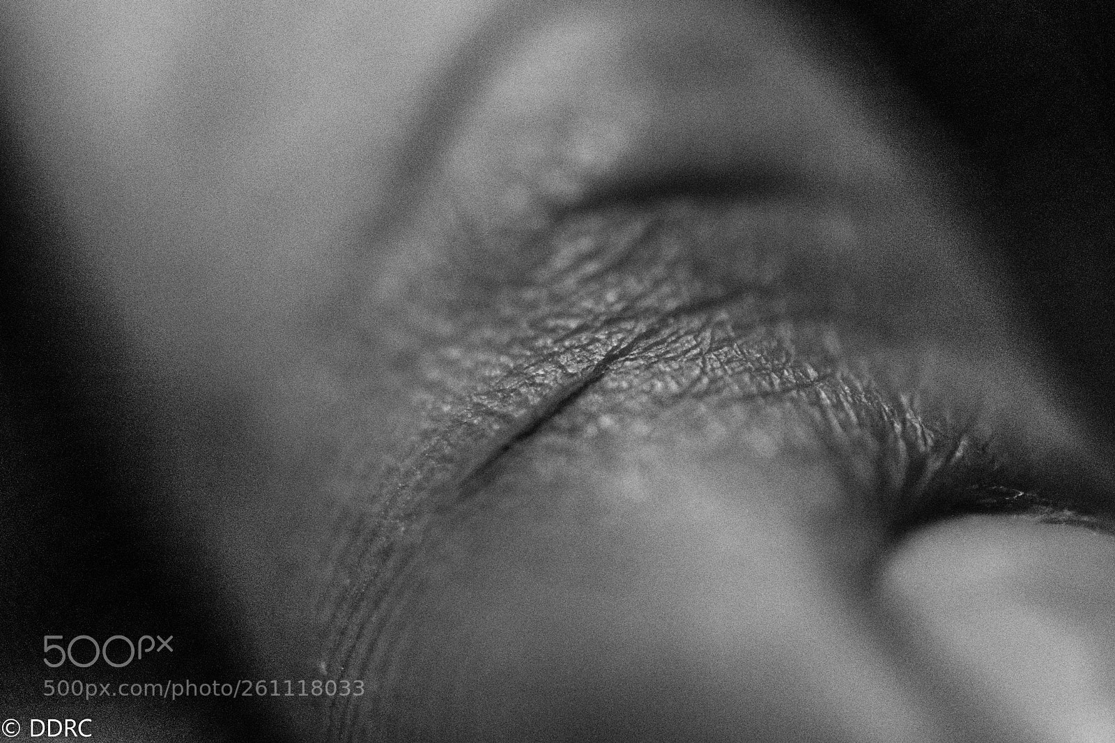 Nikon D3300 sample photo. Wound photography