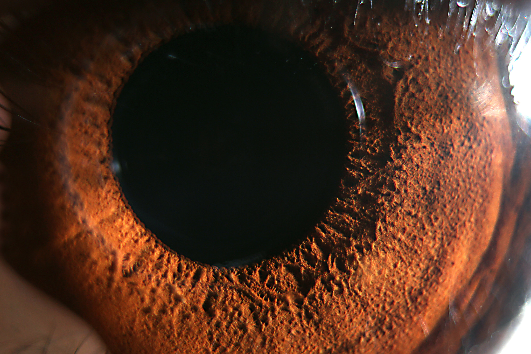 The eye of a child