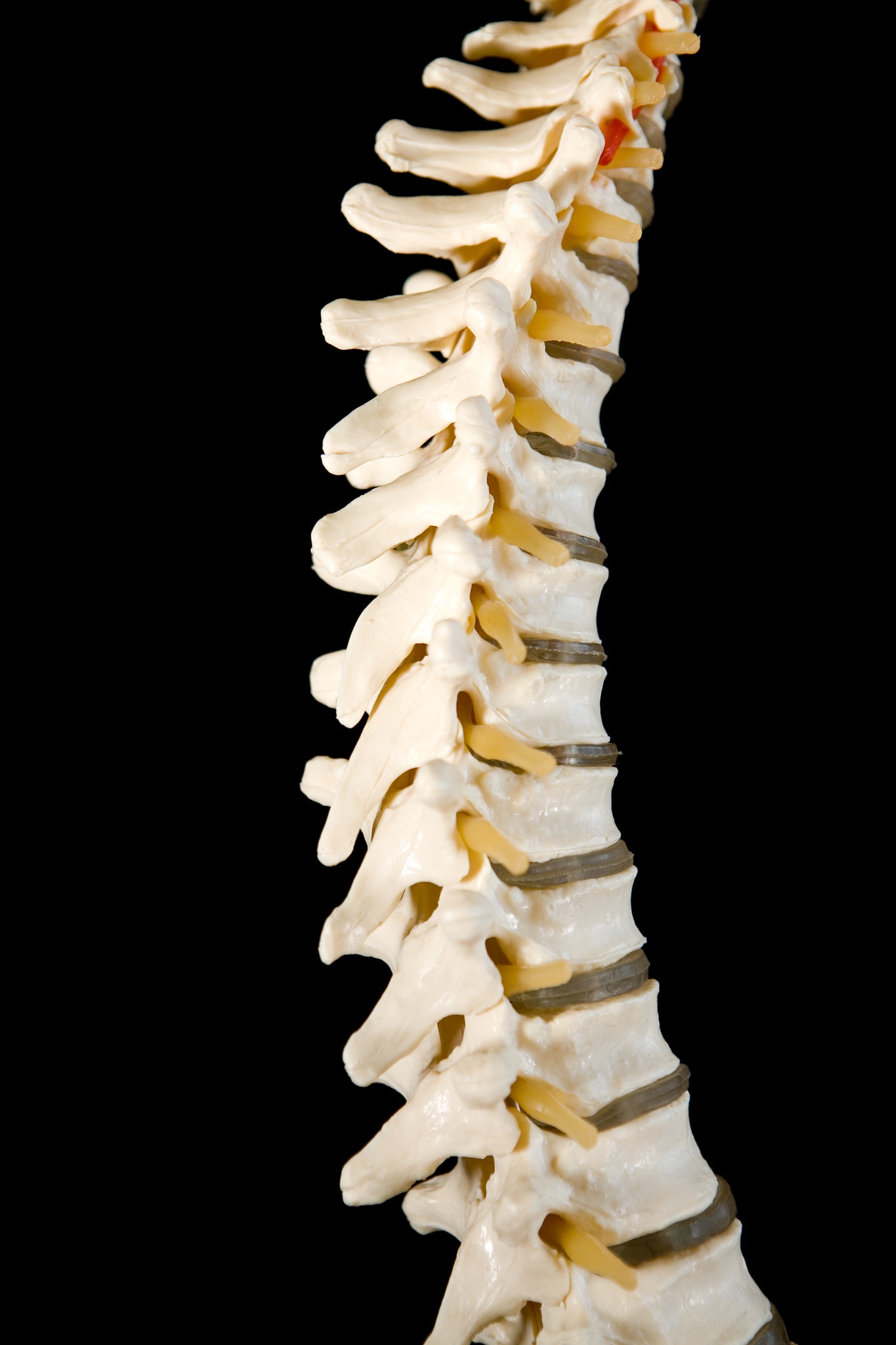 Spine 3