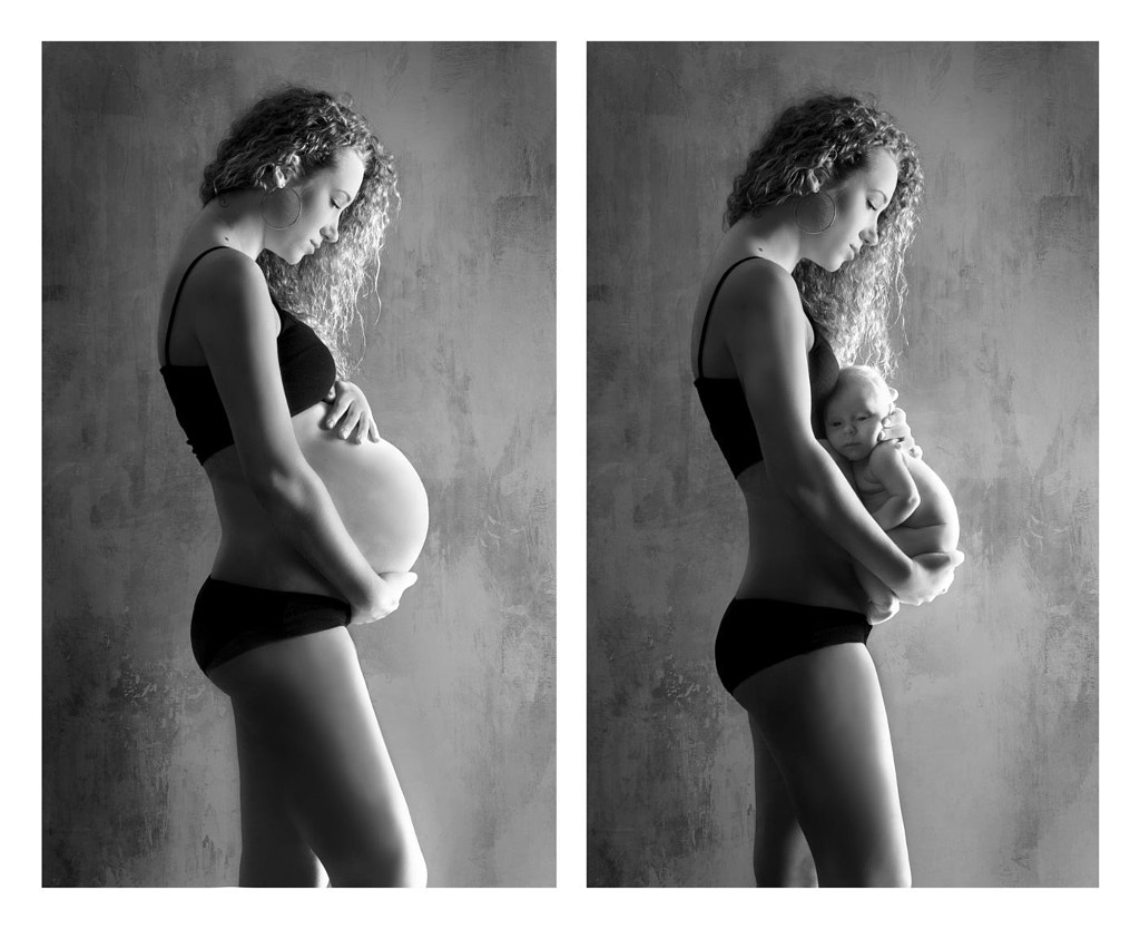 pregnancy picture ideas before and after